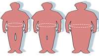 ستاد فرهنگسازی اقتصاد دانش بنیان Obesity both feeds tumors and helps immunotherapy kill cancer