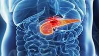 ستاد فرهنگسازی اقتصاد دانش بنیان The Potential of CAR T Cell Therapy in Pancreatic Cancer