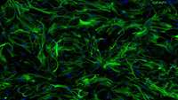 ستاد فرهنگسازی اقتصاد دانش بنیان Mechanical forces control cell fate during brain formation