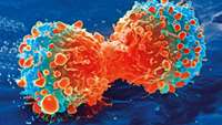 ستاد فرهنگسازی اقتصاد دانش بنیان Cancer treatment could be replicated for COVID-19