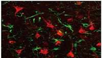 ستاد فرهنگسازی اقتصاد دانش بنیان  First non-human primate study showing promise of gene therapy for stroke repair