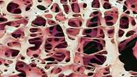 ستاد فرهنگسازی اقتصاد دانش بنیان Silk scaffolds and magnetism to generate bone tissue and be able to use it in implants