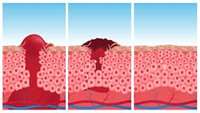 ستاد فرهنگسازی اقتصاد دانش بنیان Activation of TRPA1 nociceptor promotes systemic adult mammalian skin regeneration