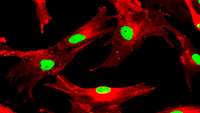 ستاد فرهنگسازی اقتصاد دانش بنیان CD146  mesenchymal stem cells display greater therapeutic potential than CD146  cells for treating collagen-induced arthritis in mice