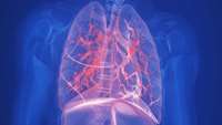 ستاد فرهنگسازی اقتصاد دانش بنیان Could mesenchymal stromal cells alleviate COPD-related inflammation?