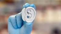 ستاد فرهنگسازی اقتصاد دانش بنیان WELSH RESEARCHERS SET TO 3D PRINT CARTILAGE FOR SCAR-FREE EAR AND NOSE TRANSPLANTS