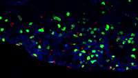 ستاد فرهنگسازی اقتصاد دانش بنیان Novel Immune Cell Population May Trigger Inflammation in Multiple Sclerosis and other Brain Disorders