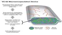 ستاد فرهنگسازی اقتصاد دانش بنیان Insulin expression and C-peptide in type 1 diabetes subjects implanted with stem cell-derived pancreatic endoderm cells in an encapsulation device