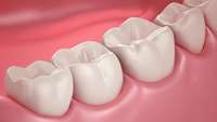 ستاد فرهنگسازی اقتصاد دانش بنیان  Further evidence shows clinical viability of natural tooth repair method