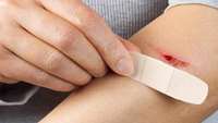 ستاد فرهنگسازی اقتصاد دانش بنیان A new scoring system for assessing wound healing