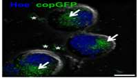 ستاد فرهنگسازی اقتصاد دانش بنیان Extracellular vesicles from human iPSCs enhance reconstitution capacity of cord blood-derived hematopoietic stem and progenitor cells