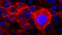 ستاد فرهنگسازی اقتصاد دانش بنیان How pancreatic cancer cells dodge drug treatments