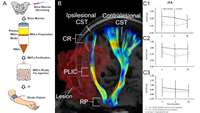 ستاد فرهنگسازی اقتصاد دانش بنیان Study provides evidence that bone marrow cell injections help heal the brain after stroke