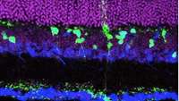 ستاد فرهنگسازی اقتصاد دانش بنیان Efficient stimulation of retinal regeneration from Müller glia in adult mice