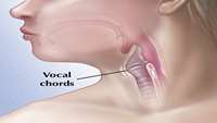 ستاد فرهنگسازی اقتصاد دانش بنیان Regenerating damaged vocal cords