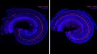 ستاد فرهنگسازی اقتصاد دانش بنیان Reversing hearing loss with regenerative therapy