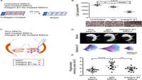 ستاد فرهنگسازی اقتصاد دانش بنیان Integrin β1, PDGFRβ, and type II collagen are essential for meniscus regeneration 