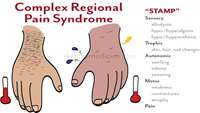 ستاد فرهنگسازی اقتصاد دانش بنیان Treatment for Complex Regional Pain Syndrome