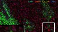 ستاد فرهنگسازی اقتصاد دانش بنیان CXCL10: a promising marker for immunotherapy response in metastatic melanoma