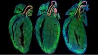 ستاد فرهنگسازی اقتصاد دانش بنیان Fixing a broken heart: These incredible images show how regenerative medicine can rebuild you