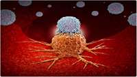 ستاد فرهنگسازی اقتصاد دانش بنیان  Chemo-immunotherapy combination shows promise against pancreatic cancer