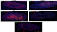 ستاد فرهنگسازی اقتصاد دانش بنیان Murine glial progenitor cells transplantation and synthetic PreImplantation Factor (sPIF) reduces inflammation and early motor impairment in ALS mice