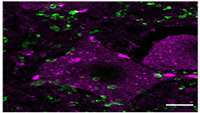 ستاد فرهنگسازی اقتصاد دانش بنیان Epigenetic Treatment Can Help the Spinal Cord Regenerate After Injury