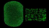 ستاد فرهنگسازی اقتصاد دانش بنیان First U.S. patient receives autologous stem cell therapy to treat dry AMD