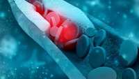 ستاد فرهنگسازی اقتصاد دانش بنیان  CRISPR cure for high cholesterol enters first human trial