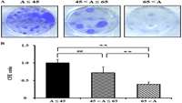 ستاد فرهنگسازی اقتصاد دانش بنیان Limbal epithelial stem cell sheets from young donors have better regenerative  potential