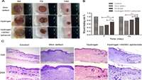 ستاد فرهنگسازی اقتصاد دانش بنیان A dopamine-methacrylated hyaluronic acid hydrogel as an effective carrier for stem cells in skin regeneration therapy