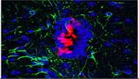 ستاد فرهنگسازی اقتصاد دانش بنیان Stem cells could repair spinal cord injuries