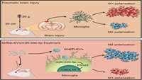 ستاد فرهنگسازی اقتصاد دانش بنیان  Dental stem cell-derived extracellular vesicles transfer miR-330-5p to treat  traumatic brain injury by regulating microglia polarization