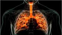 ستاد فرهنگسازی اقتصاد دانش بنیان New nanoparticles can perform gene editing in the lungs