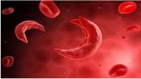 ستاد فرهنگسازی اقتصاد دانش بنیان Prime-Edited Patient Blood Stem Cells Fully Engraft and Rescue Sickle Cell Mice