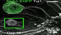 ستاد فرهنگسازی اقتصاد دانش بنیان Stem cells provide a model to understand sensorineural hearing loss