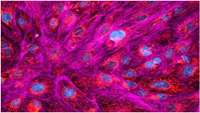 ستاد فرهنگسازی اقتصاد دانش بنیان Cell therapy using genome-edited iPS cells could be a new treatment for Fabry disease