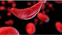 ستاد فرهنگسازی اقتصاد دانش بنیان FDA sets Dec deadline for Vertex, CRISPR sickle cell therapy