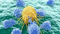 ستاد فرهنگسازی اقتصاد دانش بنیان Testing CRISPR-Edited CAR T Cell Therapy in Lymphoma Clinical Trial