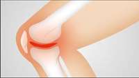 ستاد فرهنگسازی اقتصاد دانش بنیان New injectable cell therapy could resolve osteoarthritis