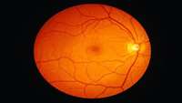 ستاد فرهنگسازی اقتصاد دانش بنیان Advances in production of retinal cells for treating blindness