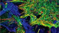 ستاد فرهنگسازی اقتصاد دانش بنیان Tufts scientists grow functioning human neural networks in 3D from stem cells