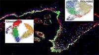 ستاد فرهنگسازی اقتصاد دانش بنیان Defining Epidermal Basal Cell States During Skin Homeostasis and Wound Healing Using Single-Cell Transcriptomics