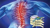 ستاد فرهنگسازی اقتصاد دانش بنیان Regulators approve autologous stem cell therapy for spinal cord injury in Japanese first