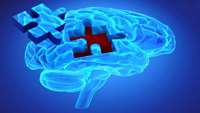 ستاد فرهنگسازی اقتصاد دانش بنیان New therapeutic strategy to treat Alzheimers