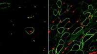 ستاد فرهنگسازی اقتصاد دانش بنیان UCLA researchers create skeletal muscle from stem cells