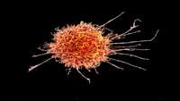 ستاد فرهنگسازی اقتصاد دانش بنیان Natural Killer Cells May Offer a Better Cancer Treatment Than CAR-T