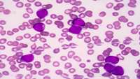 ستاد فرهنگسازی اقتصاد دانش بنیان Study identifies an unexpected cell population key to blood cancer relapse