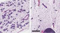 ستاد فرهنگسازی اقتصاد دانش بنیان A protein that stem cells require could be a target in killing breast cancer cells