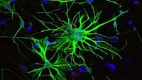 ستاد فرهنگسازی اقتصاد دانش بنیان How glial cells develop in the brain from neural precursor cells